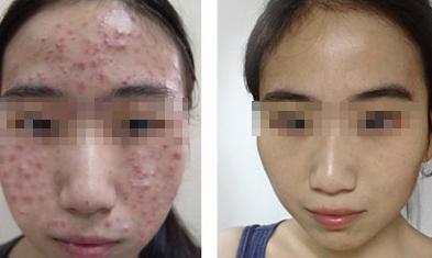 ��Ժ�����ǰ��Ա�ͼ 